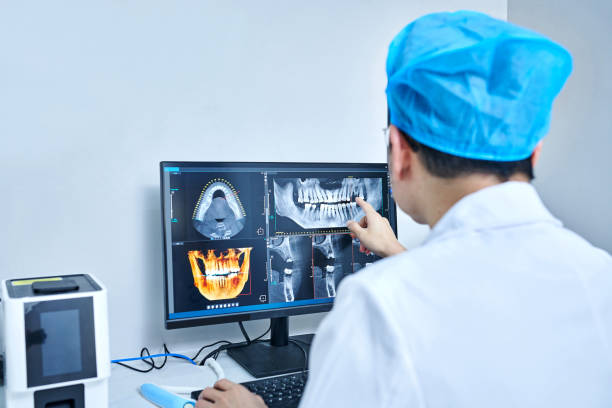 Best Emergency Dentist for Lost Fillings or Crowns in Duluth, WA