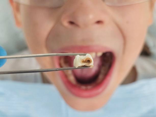 Best Pediatric Emergency Dentist in Duluth, WA